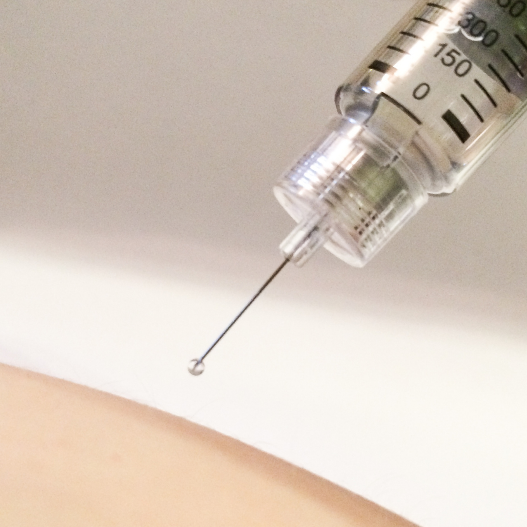 Why would you inject blind? - Dr. Fred Bagares with MSK Direct