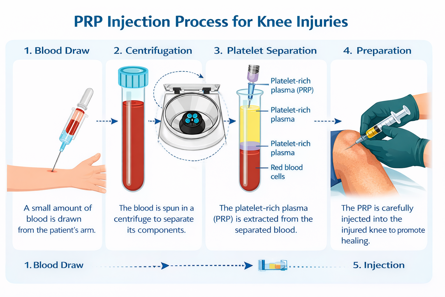 Not All PRP Is the Same — Why the Details Matter When Pain Hasn’t ...